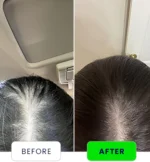 anti hairfall serum
