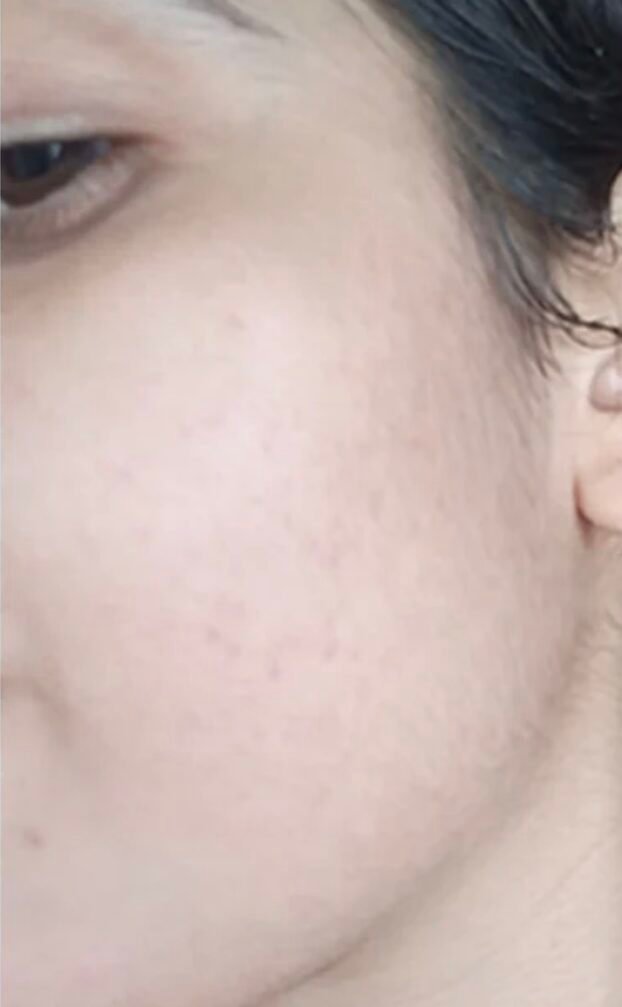 After