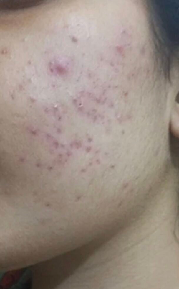 Before