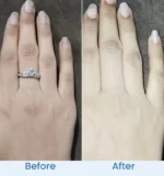 barrier-glow-before-after