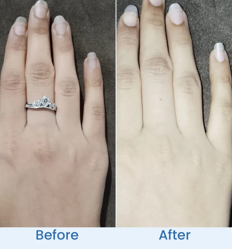 barrier-glow-before-after