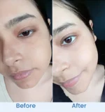 barrier-glow-page-before-after-2